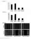 Fig. 15 - Twist signaling inhibitor compositions and methods of using the same