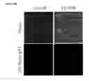Fig. 24 - Twist signaling inhibitor compositions and methods of using the same