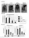 Fig. 35 - Twist signaling inhibitor compositions and methods of using the same