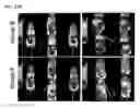 Fig. 50 - Twist signaling inhibitor compositions and methods of using the same