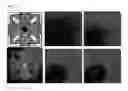 Fig. 06 - Bioactivity testing structure for single cell tracking using gelling agents