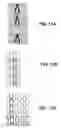 Fig. 07 - Binary encoding of sensors in textile structures