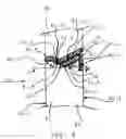 Fig. 06 - Bullet- and blast-resistant window and associated apparatus