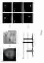 Fig. 09 - Classification apparatus for pathologic diagnosis of medical image, and pathologic diagnosis system using the same