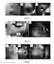 Fig. 22 - Collection and analysis of data for diagnostic purposes
