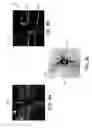Fig. 09 - Automated assessment of glaucoma loss from optical coherence tomography