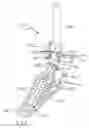 Fig. 02 - Percussion pedal assembly