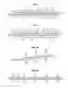 Fig. 02 - Photovoltaic module comprising a plurality of bifacial cells and method for producing such a module