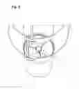 Fig. 08 - INSECT TRAP ASSEMBLY