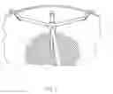 Fig. 04 - Filling foodstuffs having a solid and a liquid component