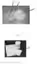 Fig. 02 - Edible compositions and methods