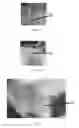 Fig. 05 - Edible compositions and methods