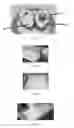 Fig. 07 - Edible compositions and methods