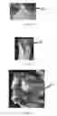 Fig. 08 - Edible compositions and methods