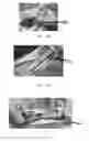 Fig. 13 - Edible compositions and methods