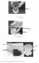 Fig. 14 - Edible compositions and methods