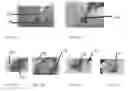 Fig. 23 - Edible compositions and methods