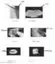 Fig. 25 - Edible compositions and methods