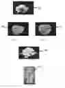 Fig. 26 - Edible compositions and methods