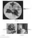 Fig. 28 - Edible compositions and methods