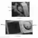 Fig. 31 - Edible compositions and methods