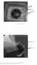 Fig. 32 - Edible compositions and methods