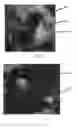 Fig. 33 - Edible compositions and methods