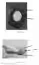 Fig. 34 - Edible compositions and methods