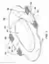Fig. 02 - Knee pad system