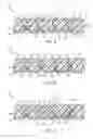 Fig. 08 - Dual layer sole system with auxetic structure
