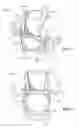Fig. 02 - Front-Back Pack