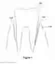 Fig. 02 - Dental brush