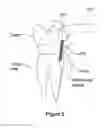 Fig. 06 - Dental brush