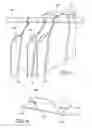 Fig. 06 - HANGING SEPARATOR TO BE USED FOR SEPARATING ARTICLES OF CLOTHING HANGING IN A CLOTHES CLOSET, AND A PLURALITY OF HANGING SEPARATORS FORMING A SYSTEM FOR SEPARATING ARTICLES OF CLOTHING HANGING IN A CLOTHES CLOSET
