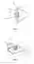 Fig. 02 - Background reduction apparatuses and methods of ocular surface interferometry (OSI) employing polarization for imaging, processing, and/or displaying an ocular tear film