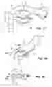 Fig. 09 - Surgical instruments, systems and methods of use