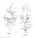 Fig. 06 - Needle and guide apparatus for passing suture