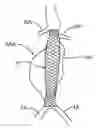 Fig. 01 - Methods and systems for aneurysm treatment using filling structures