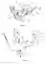 Fig. 02 - High tibial osteotomy external fixator