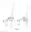 Fig. 06 - High tibial osteotomy external fixator