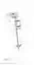 Fig. 49 - Systems and methods for joint replacement