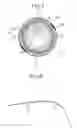 Fig. 07 - Medical device and method for treatment