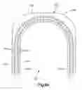 Fig. 09 - External bone fixation device