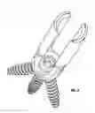 Fig. 06 - Uniplanar Screw