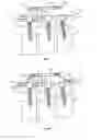 Fig. 03 - Spinal alignment and securement