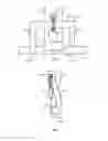 Fig. 05 - Spinal alignment and securement