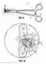 Fig. 09 - Occipital fixation assembly, system and method for attaching the same