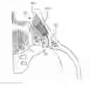 Fig. 01 - Methods for delivery of screws for joint fusion