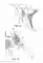 Fig. 08 - Methods for delivery of screws for joint fusion