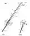 Fig. 02 - Minimally invasive spinal fixation system and related methods